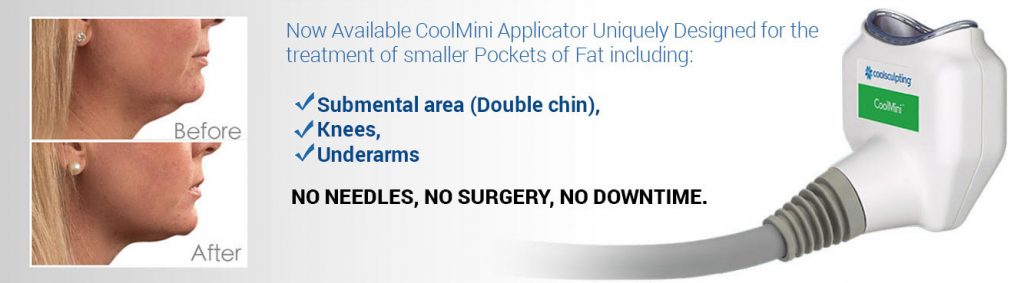 coolmini before and after treatment