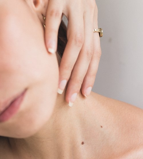 How to Prepare Your Skin for a Chemical Peel