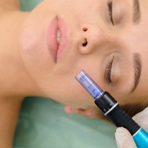 What Should I Pair With My Microneedling Treatment?